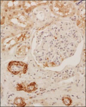 Analysis of a FFPE tissue section of human kidney using 1:200 dilution of SUCNR1/GPR91 Antibody. The staining was developed using HRP labeled anti-rabbit secondary antibody and DAB reagent, and nuclei of cells were counter-stained with hematoxylin.