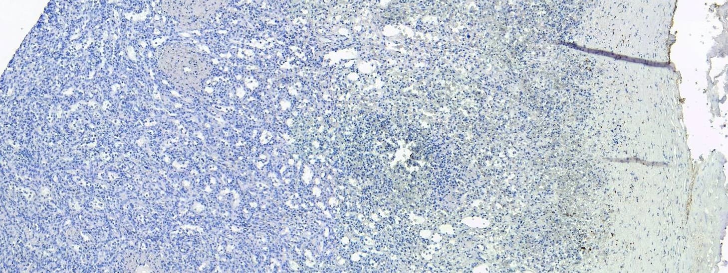 Control: Goat Polyclonal S100A9 Antibody [NBP1-18843] - Negative Control showing staining of paraffin embedded Human Spleen, with no primary antibody.
