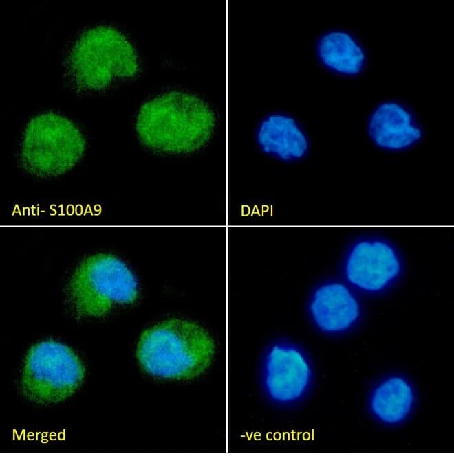 Immunocytochemistry/Immunofluorescence: Goat Polyclonal S100A9 Antibody [NBP1-18843] - Immunofluorescence analysis of paraformaldehyde fixed THP-1 cells immobilized on ShifixTM coverslip, permeabilized with 0.15% Triton. Primary incubation 1hr (10ug/ml) followed by Alexa Fluor 488 secondary antibody (2ug/ml), showing nuclear and cytoplasmic staining. The nuclear stain is DAPI (blue). Negative control: Unimmunized goat IgG (10ug/ml) followed by Alexa Fluor 488 secondary antibody (2ug/ml).