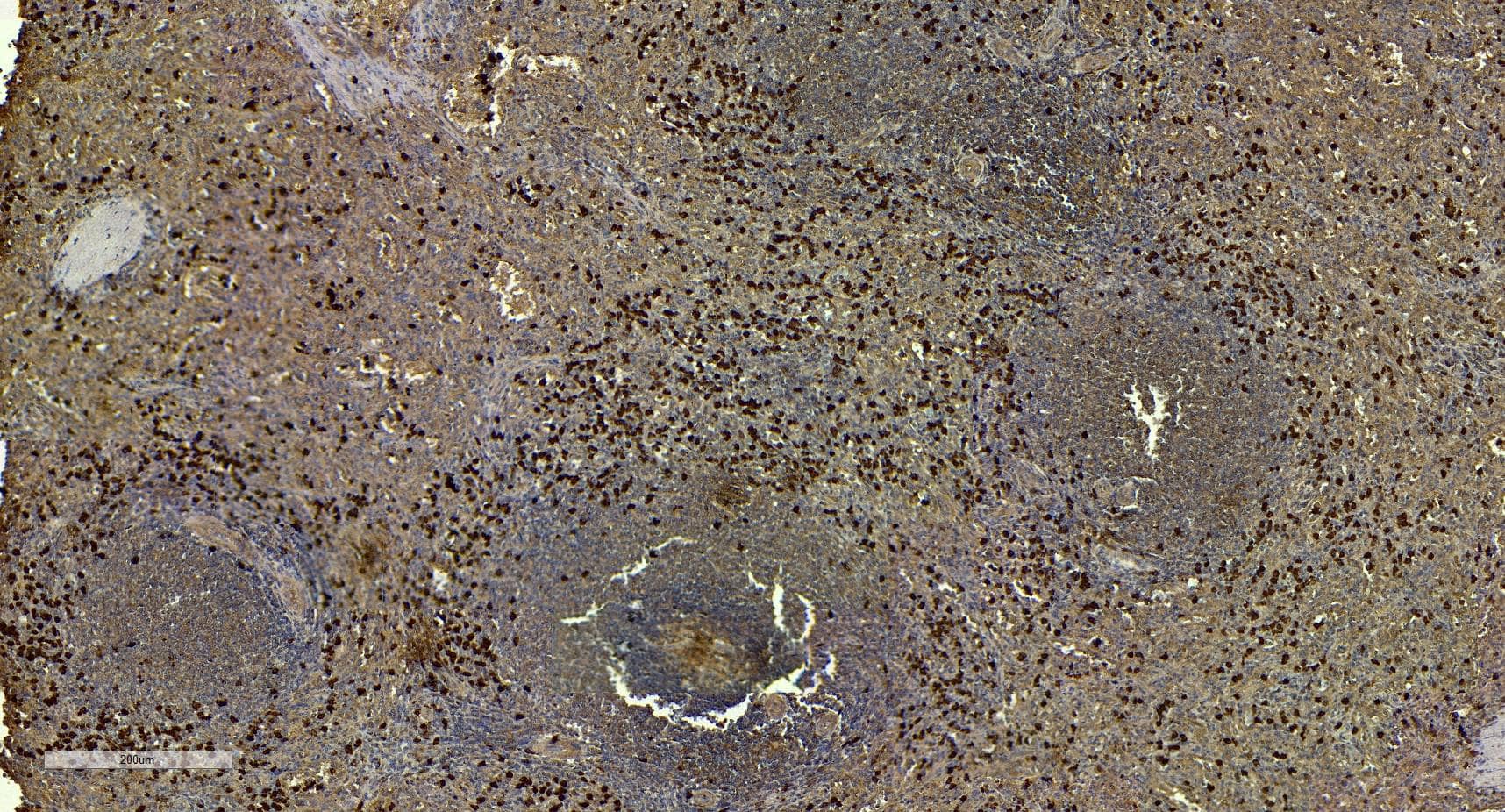 Immunohistochemistry-Paraffin: Goat Polyclonal S100A9 Antibody [NBP1-18843] - (7µg/ml) staining of paraffin embedded Human Spleen. Heat induced antigen retrieval with citrate buffer pH 6, HRP-staining.