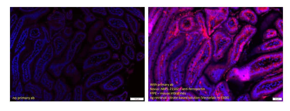 Immunohistochemistry-Paraffin: Rabbit Polyclonal Ferroportin/SLC40A1 Antibody [NBP1-21502] - Staining of mouse small intestines using Ferroportin/SLC40A1 Antibody. Tissue was fixed in formalin overnight and embedded in paraffin.  ~5 micro sections on slides were dehydrated. Antigen retrieval was done using citrate buffer in rice steamer for 20mins. 1 hour blocking without permeabilization. Overnight primary ab incubation was done 1:200 (NBP1-21502) at 4C. 2-hr secondary antibody incubation was at room temp; mounting media with DAPI. Image from a verified customer review.