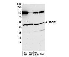 Western Blot: ADRM1 Antibody [NBP1-30447] -Whole cell lysate (50 µg) from HEK293T, My-La CD4+,MDA-MB-231, and HeLa cells prepared using NETN lysisbuffer. Antibody: Affinity purified rabbit anti-ADRM1antibody used for WB at 1 µg/ml.Detection: Chemiluminescence with an exposure time of75 seconds.