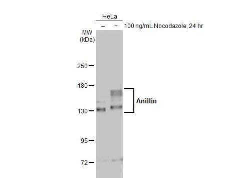 Western Blot: Anillin Antibody [NBP1-31060] - Untreated (–) and treated (+) HeLa whole cell extracts (30 ug) were separated by 5% SDS-PAGE, and the membrane was blotted with Anillin antibody [C3], C-term diluted at 1:500. The HRP-conjugated anti-rabbit IgG antibody (NBP2-19301) was used to detect the primary antibody, and the signal was developed with Trident ECL plus-Enhanced.