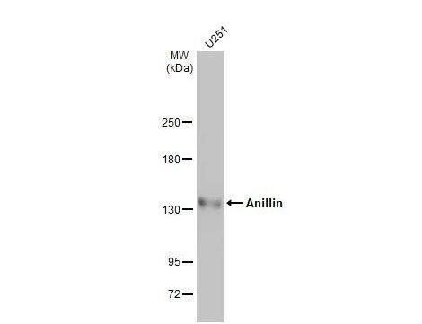 Western Blot: Anillin Antibody [NBP1-31060] - U251 whole cell extracts (30 ug) was separated by 5% SDS-PAGE, and the membrane was blotted with Anillin antibody [C3], C-term diluted at 1:500. The HRP-conjugated anti-rabbit IgG antibody (NBP2-19301) was used to detect the primary antibody.