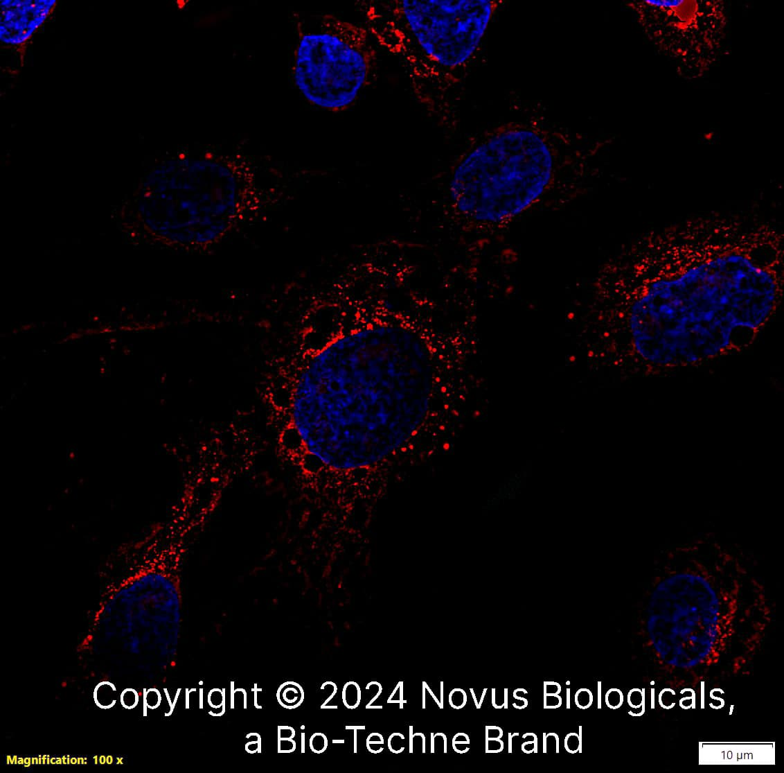 Apolipoprotein E/ApoE was detected in immersion fixed HepG2 human hepatocellular carcinoma cell line using Rabbit anti-Apolipoprotein E/ApoE Affinity Purified Polyclonal Antibody conjugated to Biotin (Catalog # NBP1-31123B) at 5 µg/mL overnight at 4C. Cells were stained using Streptavidin conjugated to DyLight 550 (red) and counterstained with DAPI (blue). Cells were imaged using a 100X objective and digitally deconvolved.