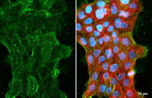 Immunocytochemistry/ Immunofluorescence CMTM6 Antibody - BSA Free