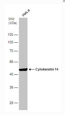 Whole cell extract (30 μg) was separated by 10% SDS-PAGE, and the membrane was blotted with Cytokeratin 14 antibody (NBP1-31326) diluted at 1:6000.