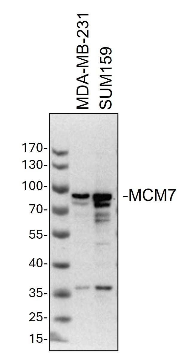 Western Blot: Rabbit Polyclonal MCM7 Antibody [NBP1-31350] - Whole cell lysates from MDA-MB-231 and SUM159 cells were loaded with 50 ug/lane.10% SDS-PAGE. MCM7 Antibody (NBP1-31350) was used for primary antibody: 1:1000, 4℃, overnight. Image from a verified customer review.