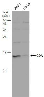 Western Blot: Citidine Deaminase Antibody [NBP1-31412] - Various whole cell extracts (30 ug) were separated by 15% SDS-PAGE, and the membrane was blotted with CDA antibody diluted at 1:1000. The HRP-conjugated anti-rabbit IgG antibody (NBP2-19301) was used to detect the primary antibody.