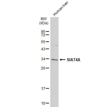 Western Blot: ST3 beta-Gal alpha-2,3-Sialyltransferase 1/ST3GAL1/SIAT4A Antibody [NBP1-31449] -Human tissue extract (30 ug) was separated by 12% SDS-PAGE, and the membrane was blotted with SIAT4A antibody diluted at 1:500. The HRP-conjugated anti-rabbit IgG antibody (NBP2-19301) was used to detect the primary antibody.