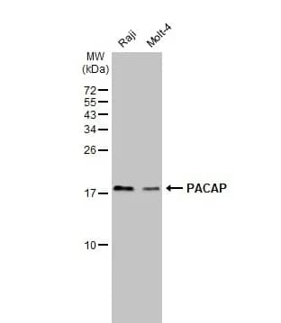 Western Blot: Proapoptotic Caspase Adaptor Protein Antibody [NBP1-31619] - Various whole cell extracts (30 μg) were separated by 15% SDS-PAGE, and the membrane was blotted with PACAP antibody [N1C3] diluted at 1:1000. The HRP-conjugated anti-rabbit IgG antibody (NBP2-19301) was used to detect the primary antibody.