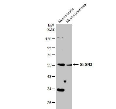 Western Blot: SESN3 Antibody [NBP1-31702] - Various tissue extracts (50 ug) were separated by 10% SDS-PAGE, and the membrane was blotted with SESN3 antibody diluted at 1:1000. The HRP-conjugated anti-rabbit IgG antibody (NBP2-19301) was used to detect the primary antibody.