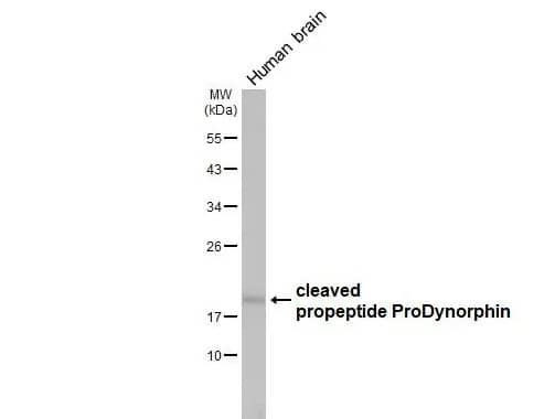 Western Blot: Prodynorphin/PDYN Antibody [NBP1-31768] - Human tissue extract (5 μg) was separated by 12% SDS-PAGE, and the membrane was blotted with ProDynorphin antibody [N1C2] diluted at 1:500. The HRP-conjugated anti-rabbit IgG antibody (NBP2-19301) was used to detect the primary antibody, and the signal was developed with Trident ECL plus-Enhanced.