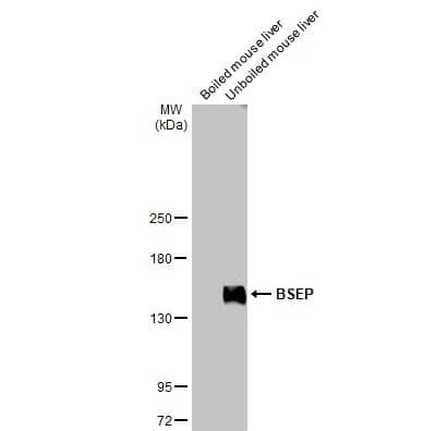 Western Blot: ABCB11 Antibody [NBP1-31824] -Boiled and unboiled mouse liver extracts (50 μg) were separated by 5% SDS-PAGE, and the membrane was blotted with BSEP antibody [N3C1], Internal diluted at 1:1000. The HRP-conjugated anti-rabbit IgG antibody (NBP2-19301) was used to detect the primary antibody.