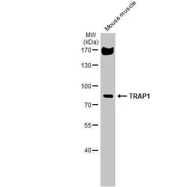 Western Blot: TRAP1 Antibody [NBP1-32097] -Mouse tissue extract (50 ug) was separated by 7.5% SDS-PAGE, and the membrane was blotted with TRAP1 antibody diluted at 1:1000. The HRP-conjugated anti-rabbit IgG antibody (NBP2-19301) was used to detect the primary antibody.