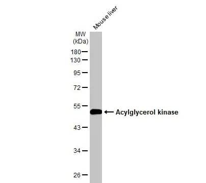 Western Blot: Acylglycerol Kinase Antibody [NBP1-32163] -Mouse tissue extract (30ug) was separated by 10% SDS-PAGE, and the membrane was blotted with Acylglycerol kinase antibody diluted at 1:1000. The HRP-conjugated anti-rabbit IgG antibody (NBP2-19301 was used to detect the primary antibody.