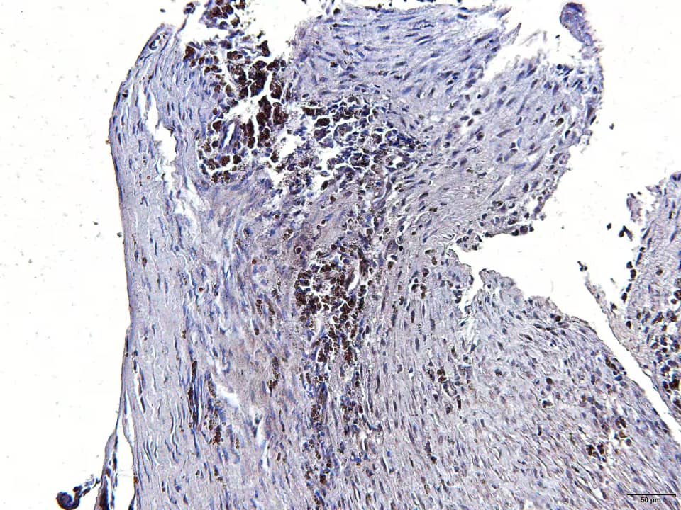 The sections of histological sections of goat bone fragments were deparaffinized, peroxidase blocked in methanol and 30% hydrogen peroxide (9:1), and antigen retrieval was performed with porcine gastric pepsin and HCl at pH 3.0 in an oven at 37°C for 30 minutes. Then, blocking with BSA was performed for 1 hour followed by incubation with the primary antibody BMPR-2 antibody NBP1-32218 (1:100) overnight. Subsequently, excess primary antibody was removed with PBS pH 7.6 and incubated with the secondary antibody (goat anti-rabbit IgG - NB7160 (1:200) for 1 hour and polymer was applied for 30 minutes. Finally, 150 μL of DAB was applied for five minutes and counterstained with hematoxylin. Image from a verified customer review.