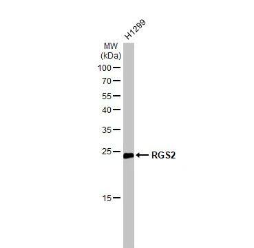 Western Blot: RGS2 Antibody [NBP1-32284] -Whole cell extract (30 ug) was separated by 12% SDS-PAGE, and the membrane was blotted with RGS2 antibody diluted at 1:1000. The HRP-conjugated anti-rabbit IgG antibody (NBP2-19301) was used to detect the primary antibody.