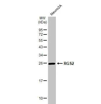 Western Blot: RGS2 Antibody [NBP1-32284] - Whole cell extract (30 ug) was separated by 12% SDS-PAGE, and the membrane was blotted with RGS2 antibody diluted at 1:1000. The HRP-conjugated anti-rabbit IgG antibody (NBP2-19301) was used to detect the primary antibody.