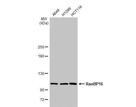 Western Blot: RanBP16 Antibody [NBP1-32350] -Various whole cell extracts (30 ug) were separated by 5% SDS-PAGE, and the membrane was blotted with RanBP16 antibody [C2C3], C-term diluted at 1:1000. The HRP-conjugated anti-rabbit IgG antibody (NBP2-19301) was used to detect the primary antibody.