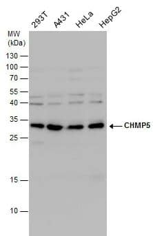 Western Blot: CHMP5 Antibody [NBP1-32597] -CHMP5 antibody detects CHMP5 protein by Western blot analysis. Various whole cell extracts (30 ug) were separated by 15 % SDS-PAGE, and blotted with CHMP5 antibody diluted by 1:1000