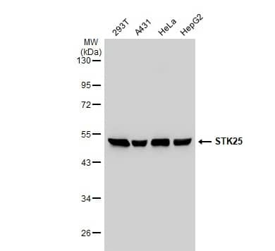 Western Blot: STK25 Antibody [NBP1-32670] -Various whole cell extracts (30 μg) were separated by 10% SDS-PAGE, and the membrane was blotted with STK25 antibody [N1C1] diluted at 1:1000. The HRP-conjugated anti-rabbit IgG antibody (NBP2-19301) was used to detect the primary antibody.