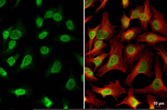 Immunocytochemistry/ Immunofluorescence PDE6D Antibody