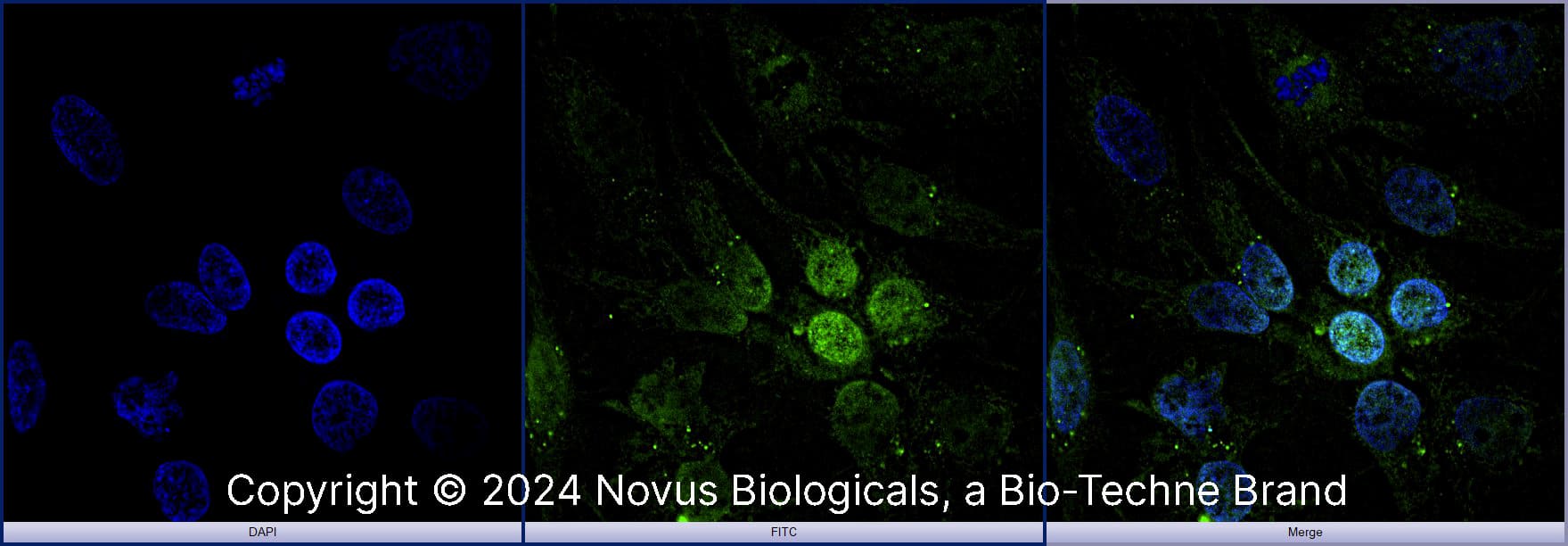 Arginase 1/ARG1/liver Arginase was detected in immersion fixed HepG2 human hepatocellular carcinoma cell line using Rabbit anti-Arginase 1/ARG1/liver Arginase Affinity Purified Polyclonal Antibody conjugated to FITC (Catalog # NBP1-32731F) (green) at 10 µg/mL overnight at 4C. Cells were counterstained with DAPI (dark blue). Cells were imaged using a 100X objective and digitally deconvolved.