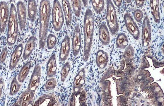 Immunohistochemistry-Paraffin: Villin 1 Antibody [NBP1-32841] - Cat colon.VIL1 stained by Villin antibody diluted at 1:500.Antigen Retrieval: Citrate buffer, pH 6.0, 15 min