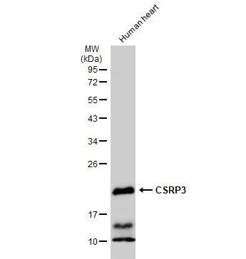 Western Blot: CSRP3 Antibody [NBP1-32974] - Human heart (30 ug) was separated by 12% SDS-PAGE, and the membrane was blotted with CSRP3 antibody diluted at 1:1000. The HRP-conjugated anti-rabbit IgG antibody (NBP2-19301) was used to detect the primary antibody.