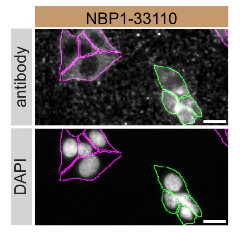 HAP1 WT and RAB6A KO cells were labelled with a green or a far-red fluorescent dye, respectively. Cells were stained with RAB6A Antibody (Catalog # NBP1-33110) and with an Alexa-fluor 555 coupled secondary antibody including DAPI. Acquisition of the blue (nucleus-DAPI), green (identification of WT cells), red (antibody staining) and far-red (identification of KO cells) channels was performed. Representative images of the blue and red (grayscale) channels are shown. WT and KO cells are outlined with green and magenta dashed line, respectively. Primary antibody dilution used: 1/800. Image, protocol and testing courtesy of YCharOS Inc. (ycharos.com).