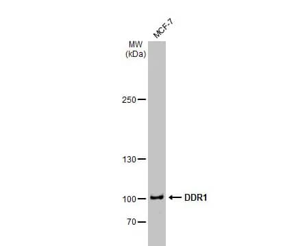 Western Blot: DDR1 Antibody [NBP1-33134] -Whole cell extract (30 μg) was separated by 5% SDS-PAGE, and the membrane was blotted with DDR1 antibody [N1N3] diluted at 1:2000. The HRP-conjugated anti-rabbit IgG antibody (NBP2-19301) was used to detect the primary antibody.