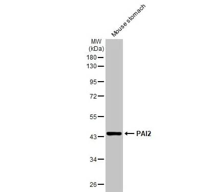 Western Blot: SerpinB2 Antibody [NBP1-33188] -Mouse tissue extract (50 μg) was separated by 10% SDS-PAGE, and the membrane was blotted with PAI2 antibody diluted at 1:1000. The HRP-conjugated anti-rabbit IgG antibody was used to detect the primary antibody, and the signal was developed with Trident ECL plus-Enhanced.