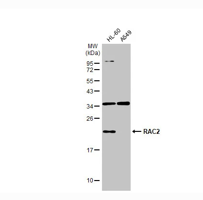 Various whole cell extracts (30 μg) were separated by 12% SDS-PAGE, and the membrane was blotted with RAC2 antibody [N1C3] (NBP1-33449) diluted at 1:1000. The HRP-conjugated anti-rabbit IgG antibody was used to detect the primary antibody.