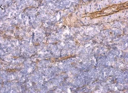 Immunohistochemistry-Paraffin TNFAIP2 Antibody