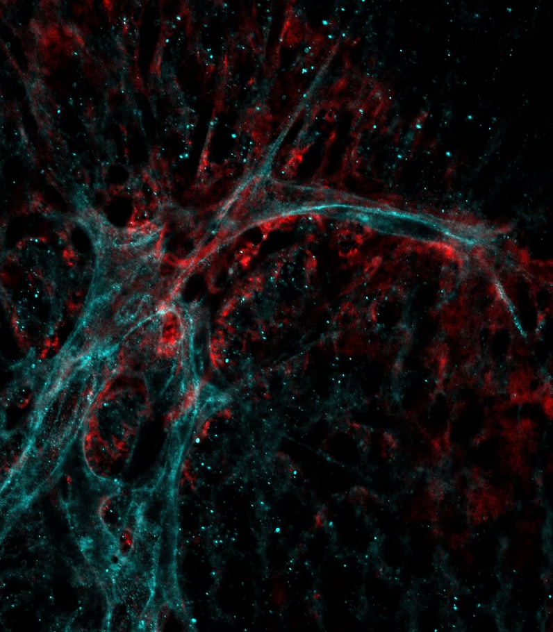 Immunohistochemistry Fibrinogen beta chain Antibody - BSA Free