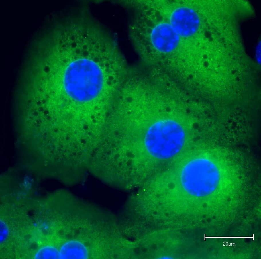 Immunocytochemistry/Immunofluorescence: Mouse Monoclonal ATF6 Antibody (70B1413.1) [IMGENEX: IMG-273] [NBP1-40256] - Mice hepatocytes were stained for ATF6. Image from a verified customer review.