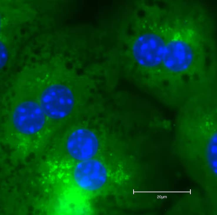 Immunocytochemistry/Immunofluorescence: Rabbit Polyclonal p62/SQSTM1 Antibody [NBP1-42821] - Mouse hepatocytes stained with p62/SQSTM1 Antibody. Image from a verified customer review.