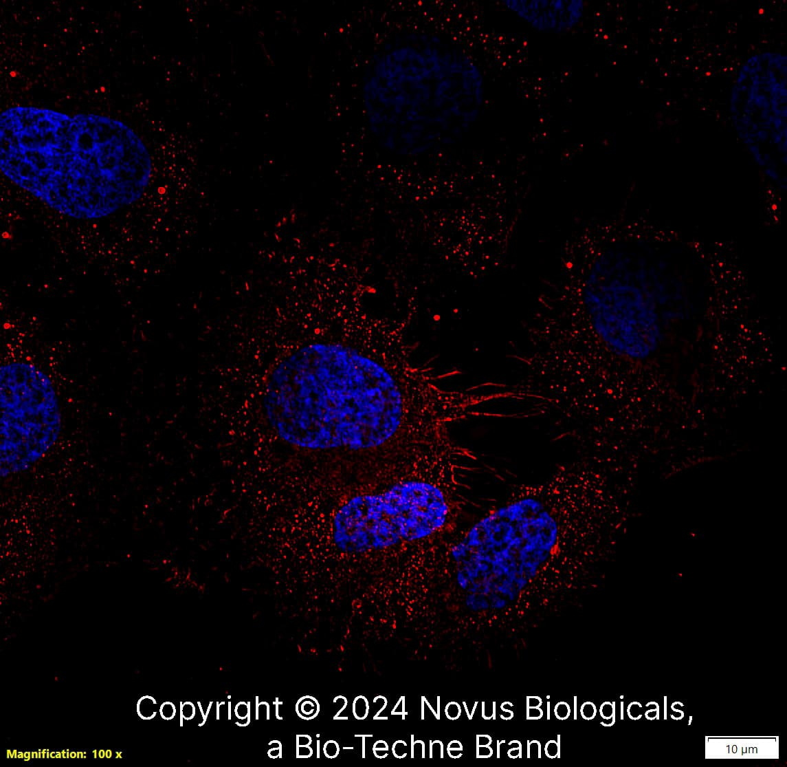 CD44 (8E2F3) was detected in immersion fixed U-2 OS human osteosarcoma cell line using Mouse anti-CD44 (8E2F3) Protein-G purified Monoclonal Antibody conjugated to Biotin (Catalog # NBP1-47386B) at 5 µg/mL overnight at 4C. Cells were stained using Streptavidin conjugated to DyLight 550 (red) and counterstained with DAPI (blue). Cells were imaged using a 100X objective and digitally deconvolved.