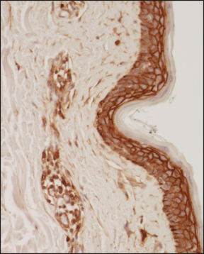 Analysis of a FFPE tissue section of human skin using 1:200 dilution of CD44 (8E2F3) antibody. The staining was developed using HRP labeled anti-mouse secondary antibody and DAB reagent, and nuclei of cells were counter-stained with hematoxylin.