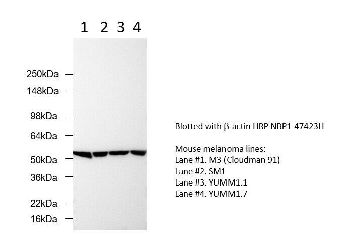 Four mouse melanoma cell lines were analyzed by Western blot using the HRP-conjugated anti– beta -actin antibody for a loading control. No secondary antibody was required, reducing assay time. Image from a verified customer review. The customer used the HRP-conjugated version of NBP1-47423, which is listed under NBP1-47423H.