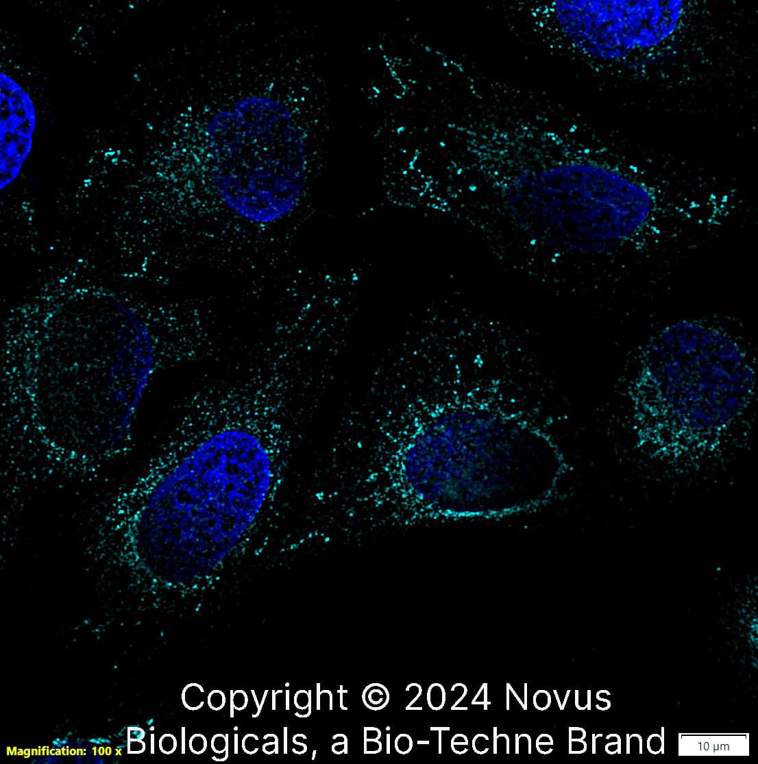 Calreticulin (1G6A7) was detected in immersion fixed U-2 OS human osteosarcoma cell line using Mouse anti-Calreticulin (1G6A7) Protein G Purified Monoclonal Antibody conjugated to Alexa Fluor® 647 (Catalog # NBP1-47518AF647) (light blue) at 5 µg/mL overnight at 4C. Cells were counterstained with DAPI (dark blue). Cells were imaged using a 100X objective and digitally deconvolved.