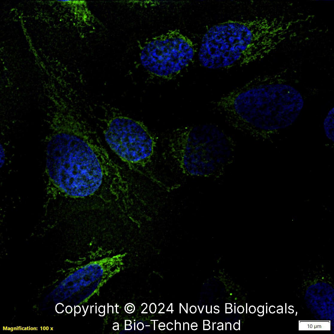 Calreticulin (1G6A7) was detected in immersion fixed U-2 OS human osteosarcoma cell line using Mouse anti- Calreticulin (1G6A7) Protein G Purified Monoclonal Antibody conjugated to FITC (Catalog # NBP1-47518F) (green) at 5 µg/mL overnight at 4C. Cells were counterstained with DAPI (dark blue). Cells were imaged using a 100X objective and digitally deconvolved.