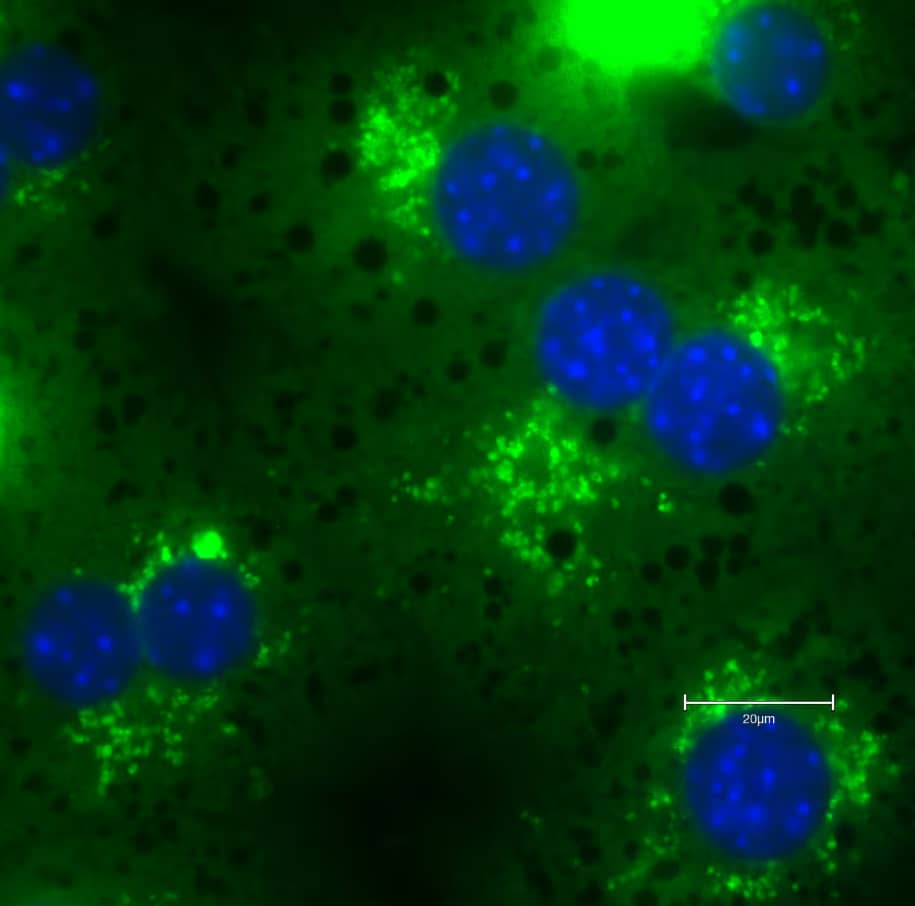 Immunocytochemistry/Immunofluorescence: Rabbit Polyclonal p62/SQSTM1 Antibody [NBP1-48320] - Mice hepatocytes stained with p62/SQSTM1 Antibody. Image from a verified customer review.