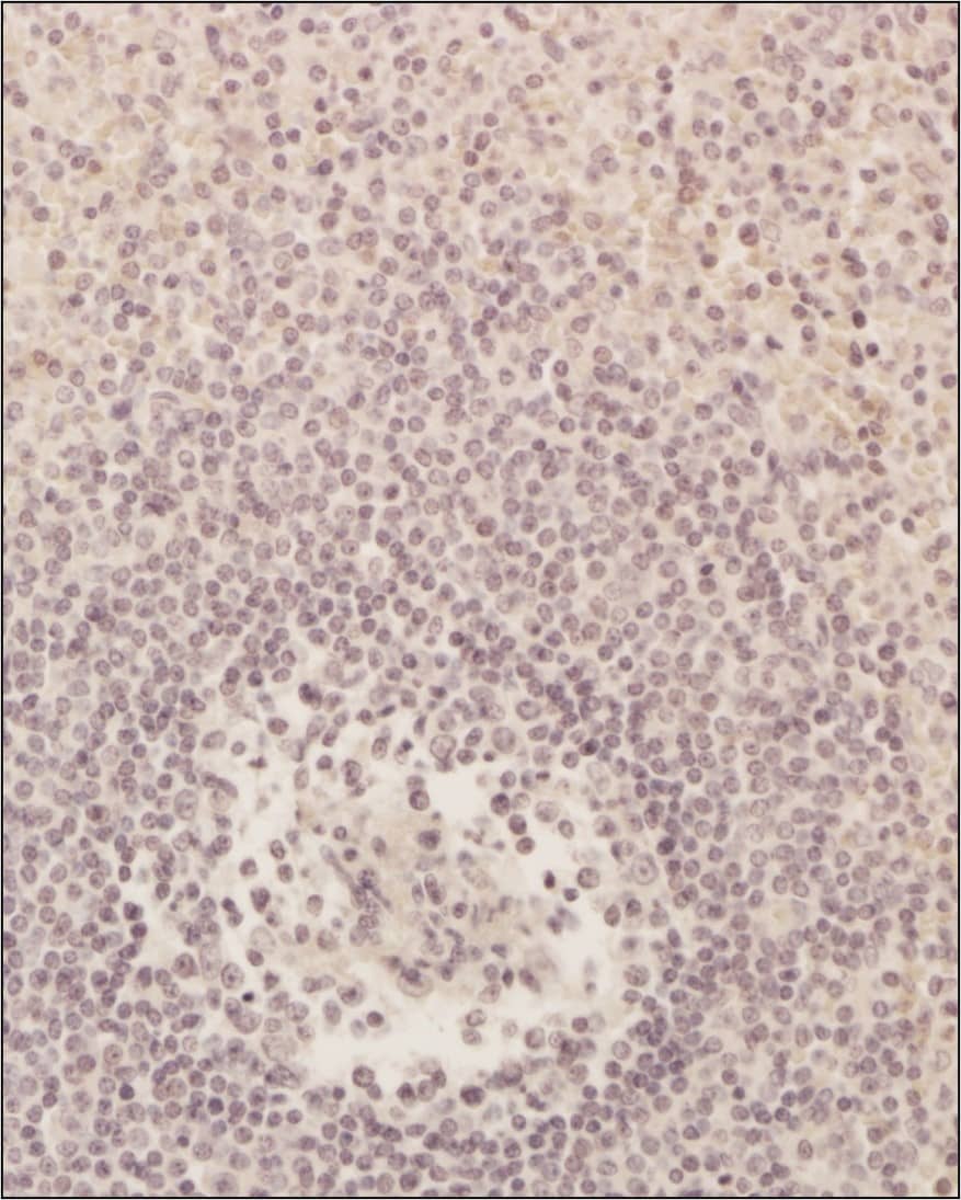 Immunohistochemistry-Paraffin: CD8 Antibody (53-6.7) [NBP1-49045] - CD8 alpha Antibody (53-6.7) [NBP1-49045] - CD8 alpha expression in human spleen tissue using anti-CD8 alpha antibody.