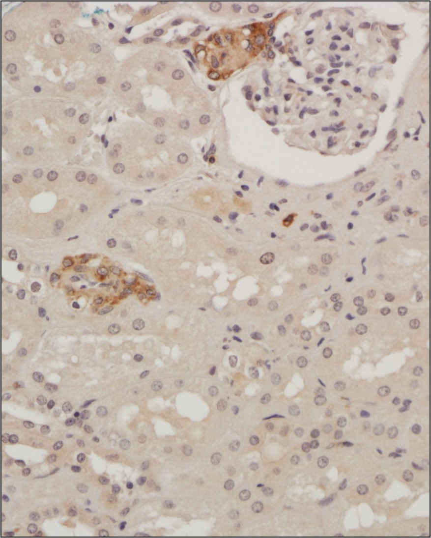 Immunohistochemistry: Glut4 Antibody [NBP1-49533] - Analysis of a FFPE tissue section of human kidney using 1:200 dilution of Glut4 antibody. The staining was developed using HRP labeled anti-rabbit secondary antibody and DAB reagent, and nuclei of cells were counter-stained with hematoxylin.