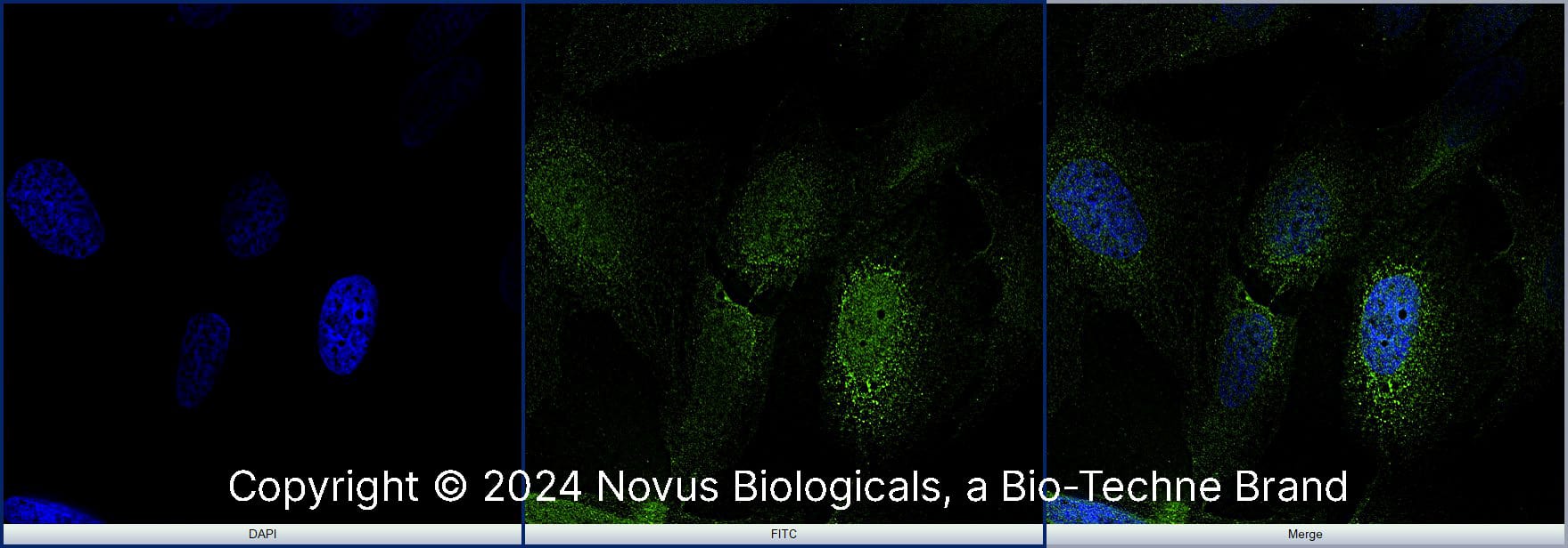 NKX6.1 was detected in immersion fixed U-2 OS human osteosarcoma cell line using Rabbit anti-NKX6.1 Antigen Affinity Purified Polyclonal Antibody conjugated to Alexa Fluor® 488 (Catalog # NBP1-49672AF488) (green) at 10 µg/mL overnight at 4C. Cells were counterstained with DAPI (blue). Cells were imaged using a 100X objective and digitally deconvolved. 