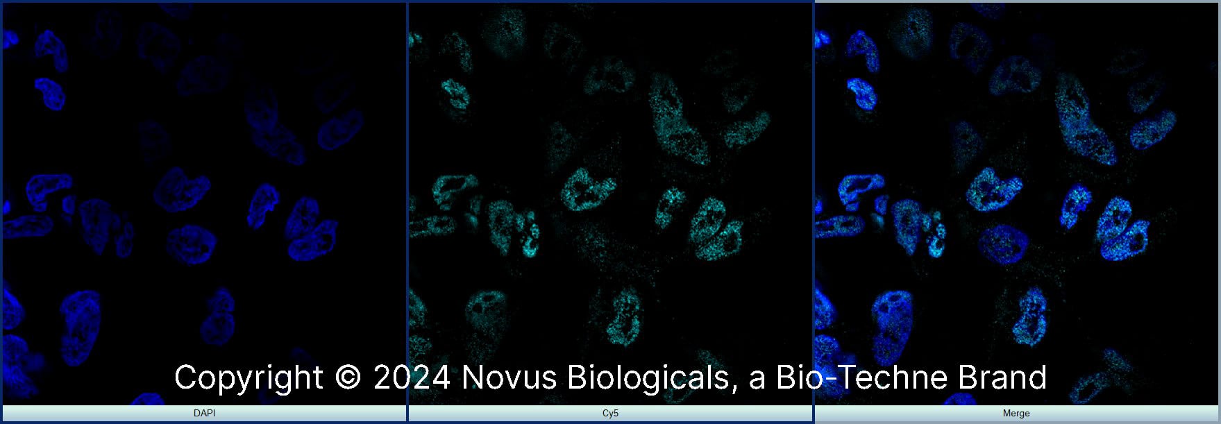 MyoD was detected in immersion fixed RD human Rhabdomyosarcoma cell line with Rabbit anti-MyoD Affinity Purified Polyclonal Antibody conjugated to Alexa Fluor® 647 (Catalog # NBP1-54153AF647) (light blue) at 5 µg/mL overnight at 4C. Cells were counterstained with DAPI (dark blue). Cells were imaged using a 100X objective and digitally deconvolved.