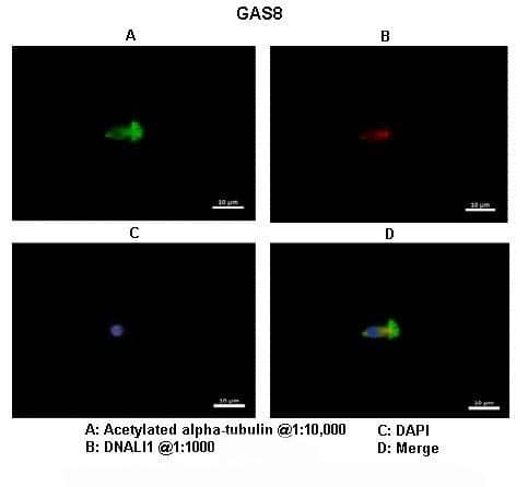 Species tissue/cell type: Human nasal epithelial cellsPrimary antibody dilution: 1:1200Secondary antibody: Goat anti-rabbit Alexa Fluor 546Secondary antibody dilution:1:1000