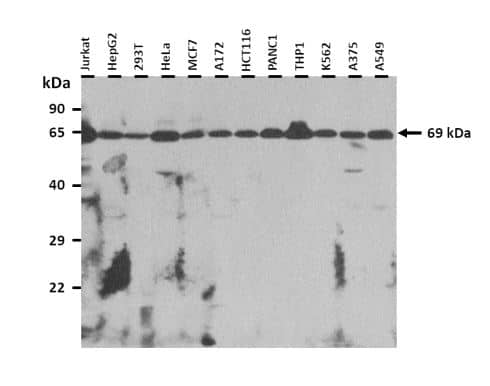 Western Blot-DMPK Antibody-NBP1-57584-258 ug of the indicated Human whole cell extracts was loaded into 12% SDS-PAGE gel. 3 ug/ml of the antibody was used in this experiment.